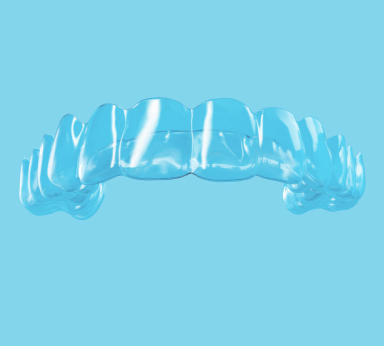 Retainer_Spark